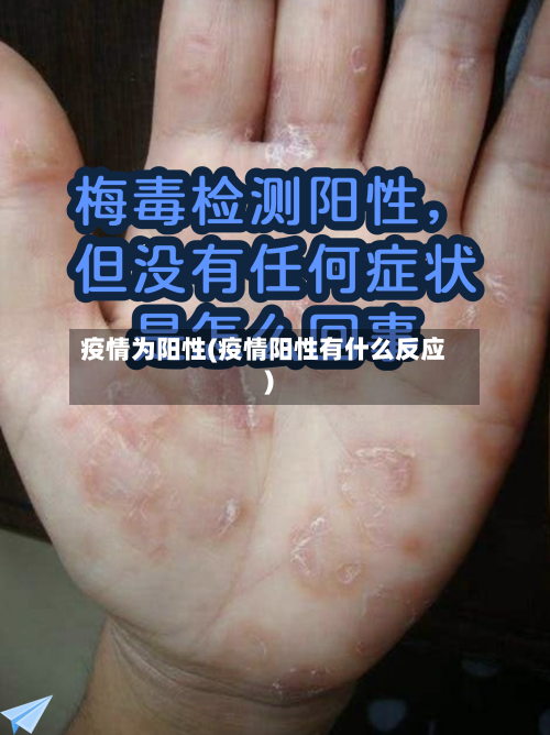 疫情为阳性(疫情阳性有什么反应)